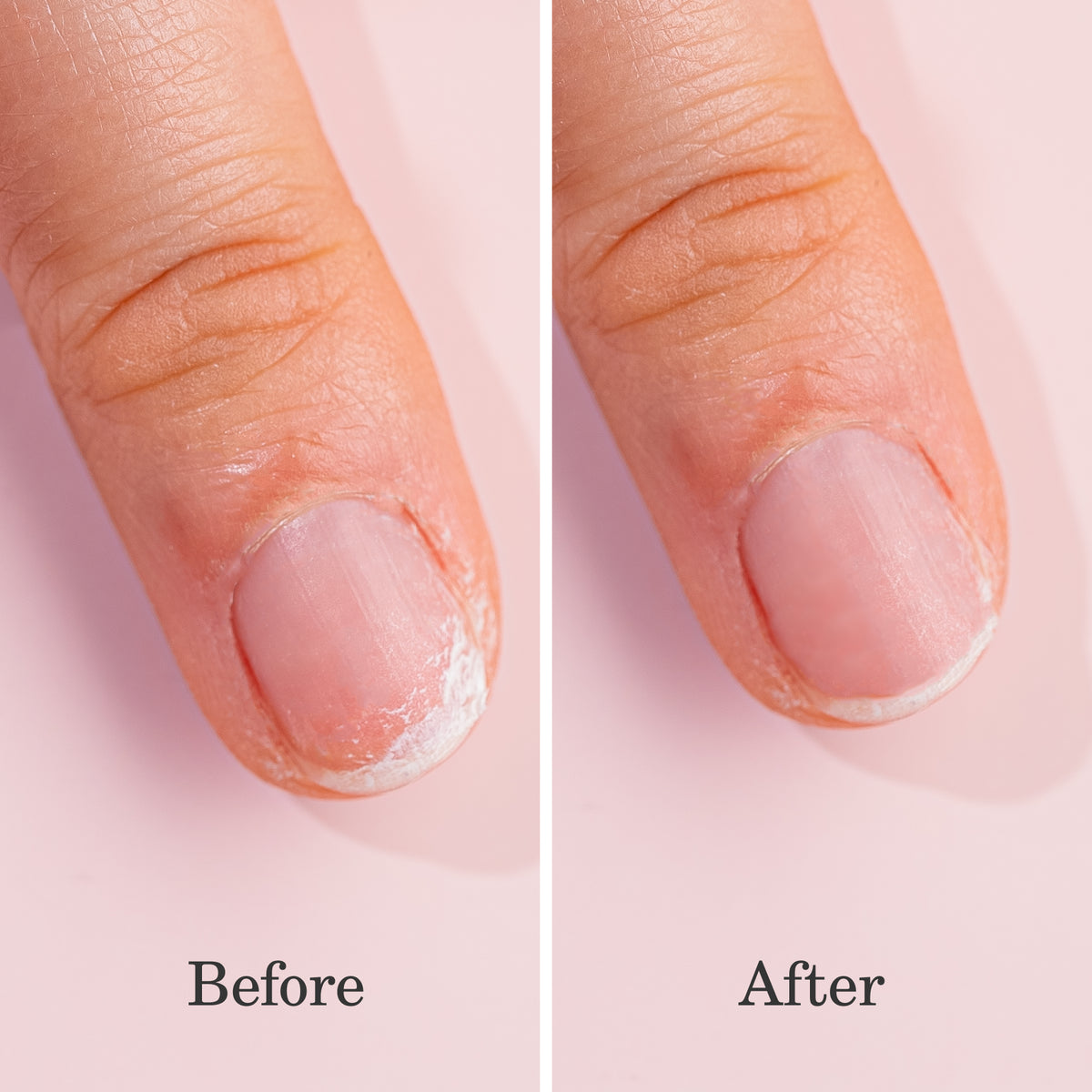 Close-up of a fingertip and nail in two side-by-side images labeled Before (dry, peeling cuticle) and After (smooth, healthy cuticle) on a light pink background.